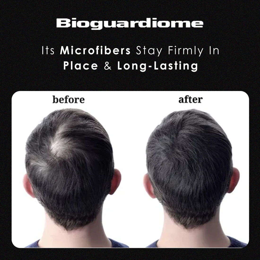 Top Solutions for Thinning Hair: How Bioguardiome Can Help
